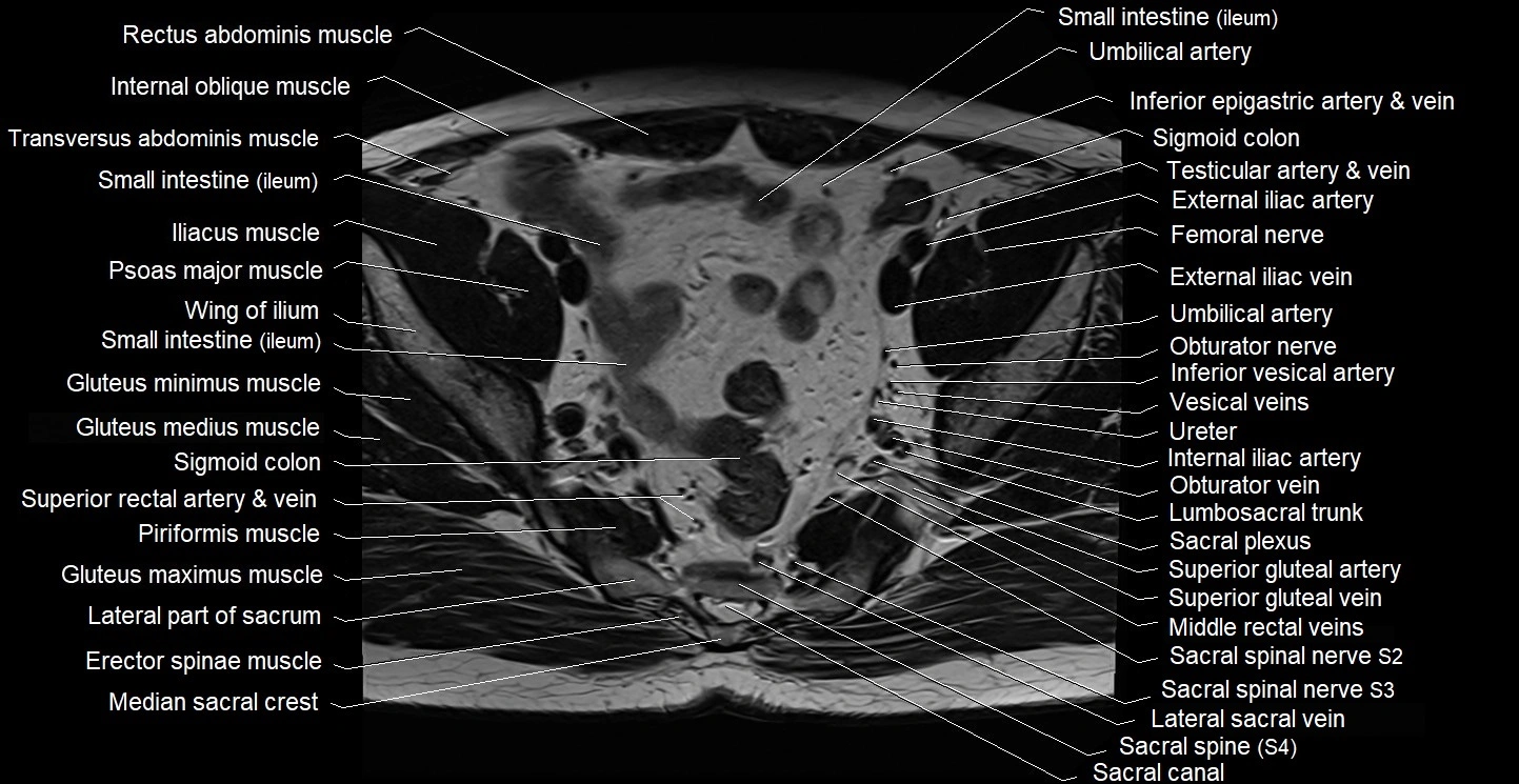 Male pelvis axial cross sectional anatomy image 13.webp